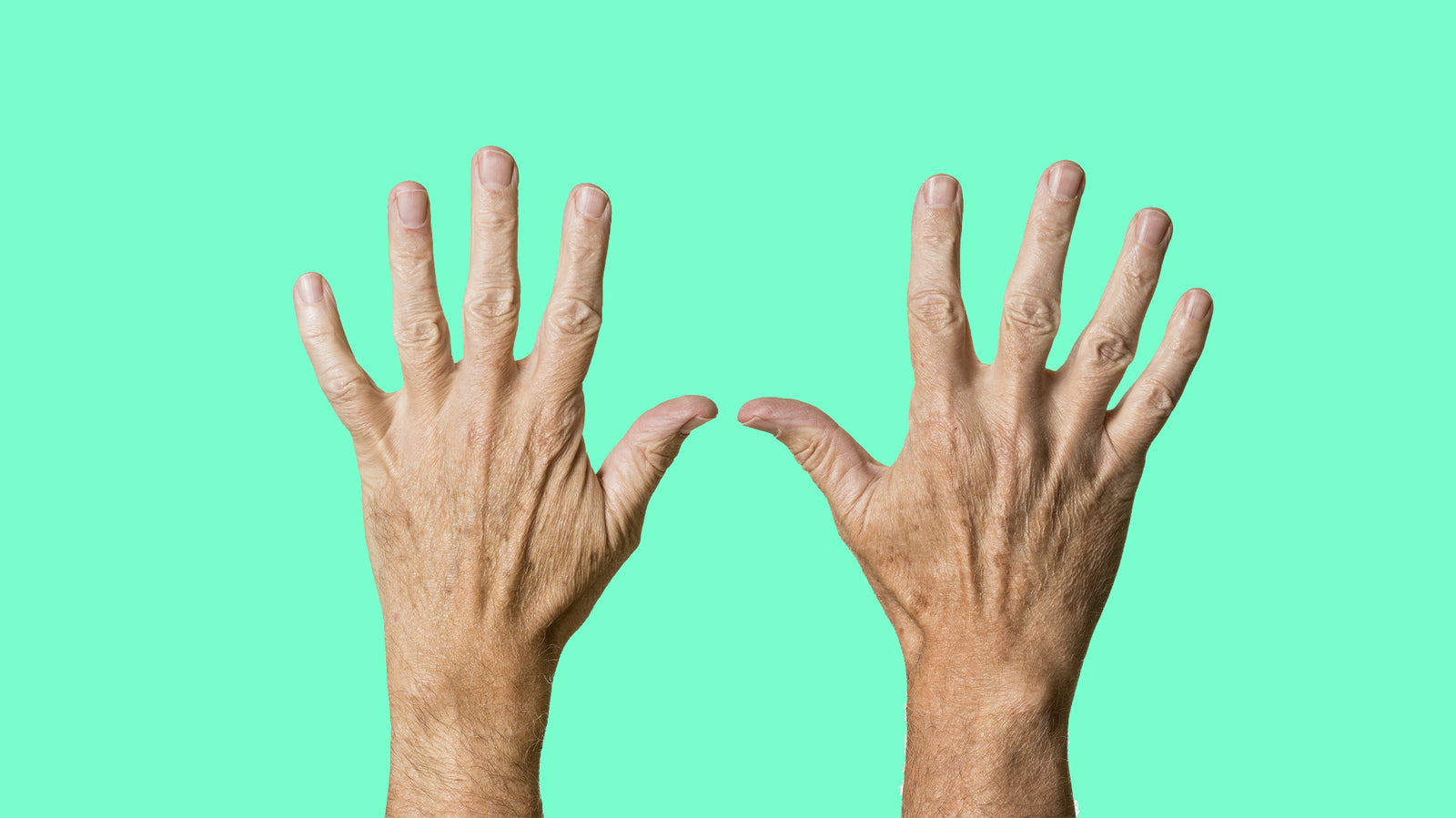 5 Ways to Get Relief from Arthritis Pain Naturally